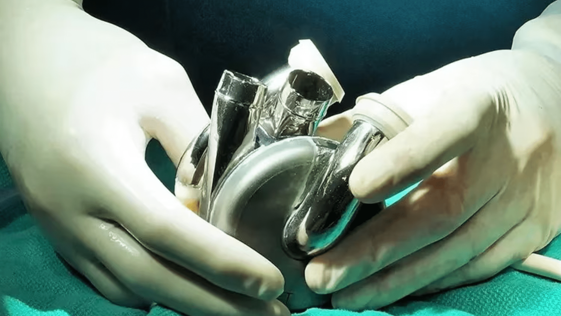 The titanium heart uses magnetic technology to pump blood